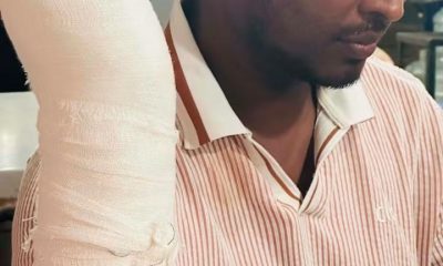 চাটখিল বাস চাপায়  আহত যুবদল নেতা-থানায় অভিযোগ করায় দেওয়া হচ্ছে গাড়ির নিচে পিষে মারার হুমকি